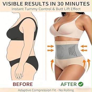 Official Brand Store | 🌾🌾 2026 MORINGA & BERBERINE 4-in-1 Micro-Particle Body Shaping & Fat-Burning Shorts